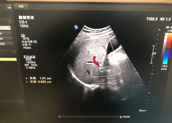 필립 C5-1 EPIQ 5 장치에 대한 복부 의료 초음파 탐사