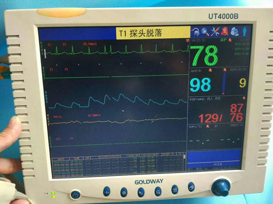 골드웨이 UT4000B 환자 모니터 수리 의료 환자 모니터 유지보수